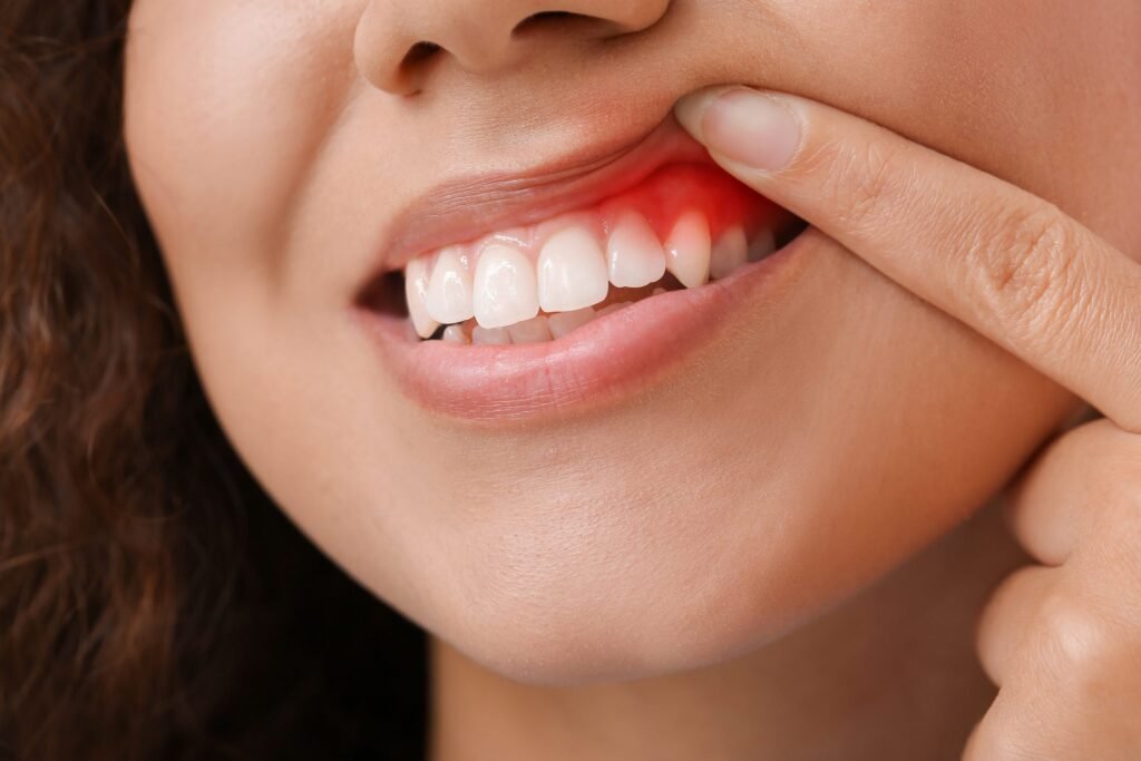 A importância de reconhecer os sinais e sintomas da doença periodontal Grupo Odontológico Carlos Teodorico