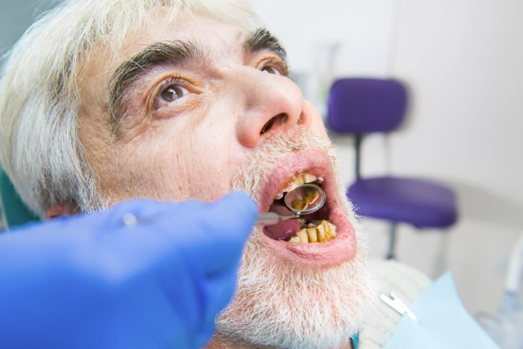 Tabagismo e diabetes: como afetam a saúde periodontal? Grupo Odontológico Carlos Teodorico