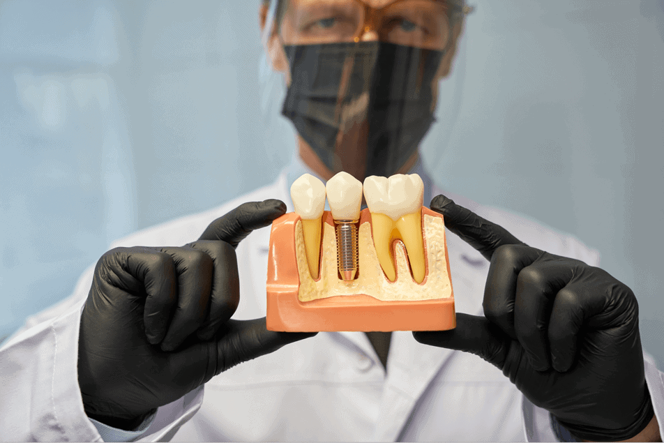 Recupere seu Sorriso com Rapidez e Segurança: Conheça o Protocolo de Carga Imediata Grupo Odontológico Carlos Teodorico