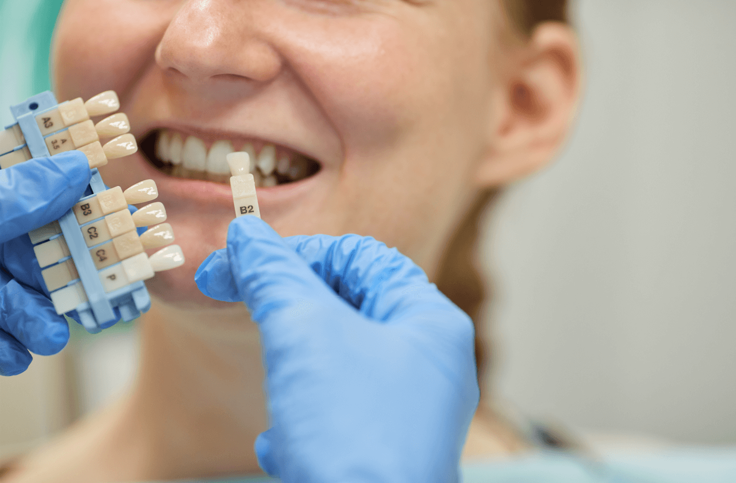 Implantes Dentários em BH: Descubra os Mais Recomendados Atualmente Grupo Odontológico Carlos Teodorico